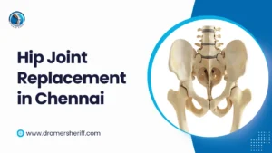 Hip Joint Replacement in Chennai