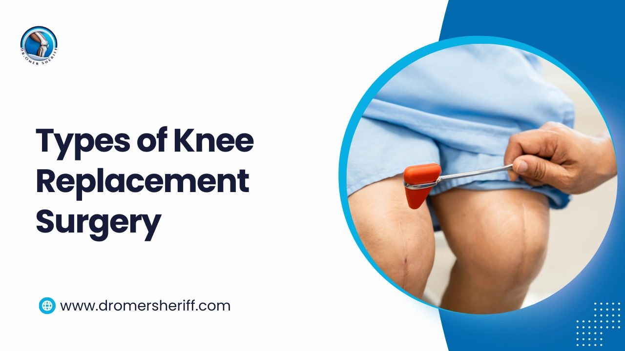 Types of Knee Replacement Surgery