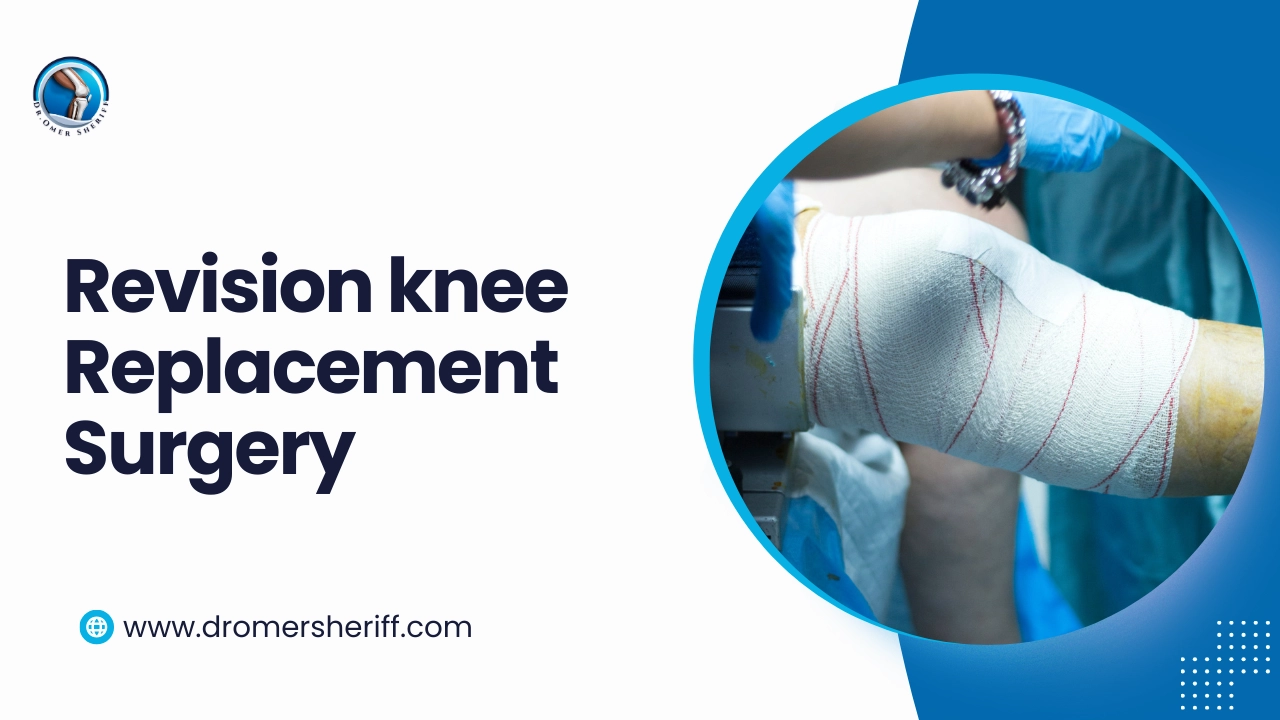 revision knee replacement surgery