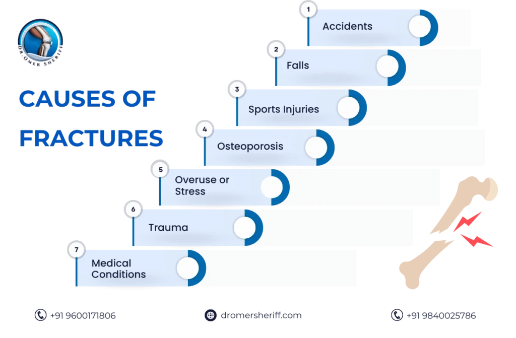 Fracture Treatment in Chennai